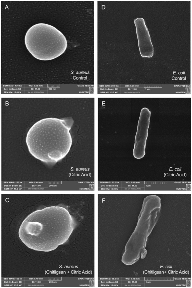 Electron microscope images of bacteria exposed to Chitligsan